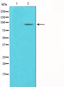 Western blot analysis on COLO205 cell lysate using PCAF Antibody. The lane on the left is treated with the antigen-specific peptide.