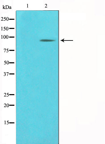 Western blot analysis on COLO205 cell lysate using PCAF Antibody. The lane on the left is treated with the antigen-specific peptide.