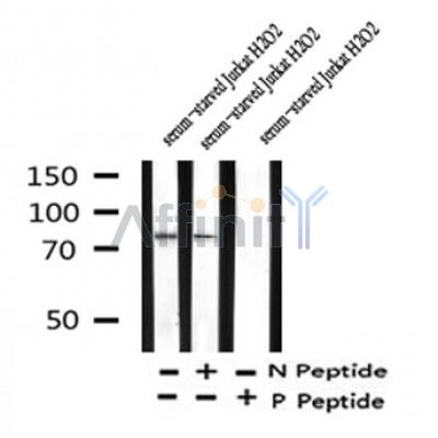 Western blot analysis of Phospho-SLP-76 (Ser376) in lysates of serum-starved Jurkat?H2O2, using Phospho-SLP-76 (Ser376) Antibody(AF4461).