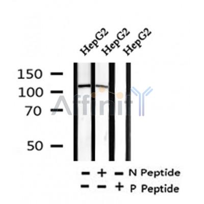 Western blot analysis of Phospho-PLD1 (Thr147) in lysates of HepG2?, using Phospho-PLD1 (Thr147) Antibody(AF4465).