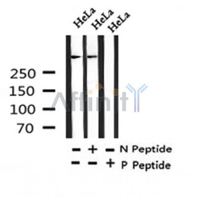 Western blot analysis of Phospho-ATR (Thr1989) in lysates of HeLa?, using Phospho-ATR (Thr1989) Antibody(AF4467).