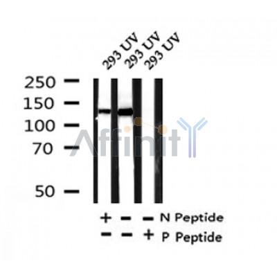 Western blot analysis of Phospho-SMC1 (Ser360) in lysates of 293  UV, using Phospho-SMC1 (Ser360) Antibody(AF4473).