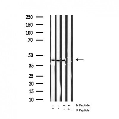 AF3316 staining 293 by IF/ICC. The sample were fixed with PFA and permeabilized in 0.1% Triton X-100,then blocked in 10% serum for 45 minutes at 25¡ãC. The primary antibody was diluted at 1/200 and incubated with the sample for 1 hour at 37¡ãC. An  Alexa Fluor 594 conjugated goat anti-rabbit IgG (H+L) Ab, diluted at 1/600, was used as the secondary antibod