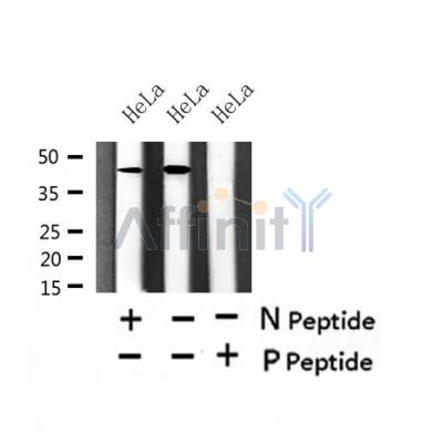 Western blot analysis of Phospho-PAR-4 (Thr163) in lysates of HeLa?, using Phospho-PAR-4 (Thr163) Antibody(AF4485).