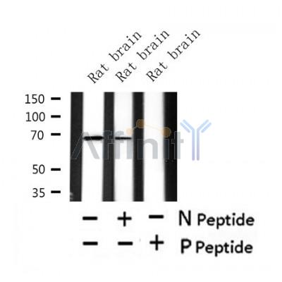 Western blot analysis of Phospho-CaMKK2 (Ser511) in lysates of Rat brain, using Phospho-CaMKK2 (Ser511) Antibody(AF4487).