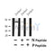Western blot analysis of Phospho-PINK1 ( T313) in lysates of Jurkat?, using Phospho-PINK1 ( T313) Antibody(AF4491).
