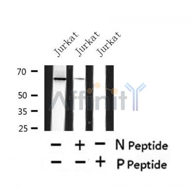 Western blot analysis of Phospho-PINK1 ( T313) in lysates of Jurkat?, using Phospho-PINK1 ( T313) Antibody(AF4491).