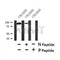 Western blot analysis of Phospho-CDCP1 (Tyr707) in lysates of COLO205, using Phospho-CDCP1 (Tyr707) Antibody(AF4492).