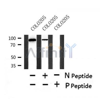Western blot analysis of Phospho-CDCP1 (Tyr707) in lysates of COLO205, using Phospho-CDCP1 (Tyr707) Antibody(AF4492).