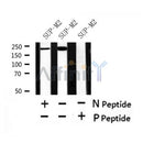 Western blot analysis of Phospho-ALK (Tyr1282/1283) in lysates of SUP-M2, using Phospho-ALK (Tyr1282/1283) Antibody(AF4501).
