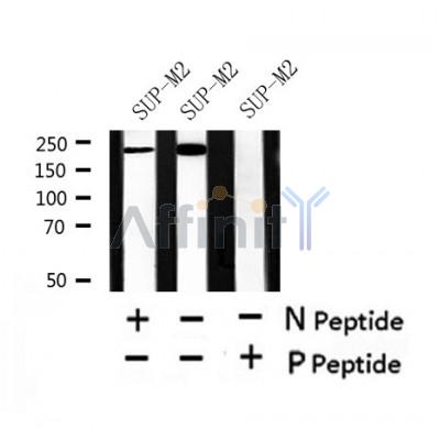 Western blot analysis of Phospho-ALK (Tyr1282/1283) in lysates of SUP-M2, using Phospho-ALK (Tyr1282/1283) Antibody(AF4501).