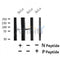 Western blot analysis of Phospho-TACC3 (Ser558) in lysates of HeLa?, using Phospho-TACC3 (Ser558) Antibody(AF4506).