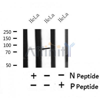 Western blot analysis of Phospho-TACC3 (Ser558) in lysates of HeLa?, using Phospho-TACC3 (Ser558) Antibody(AF4506).