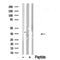 AF4600 at 1/100 staining Human Melanoma tissue by IHC-P. The sample was formaldehyde fixed and a heat mediated antigen retrieval step in citrate buffer was performed. The sample was then blocked and incubated with the antibody for 1.5 hours at 22¡ãC. An HRP conjugated goat anti-rabbit antibody was used as the secondary