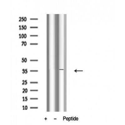 Western blot analysis of GRAP2 in lysates of Rat liver?, using GRAP2 Antibody(AF4622).
