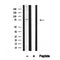 Western blot analysis of SLP76 in lysates of Jurkat serum-starved , using SLP76 Antibody(AF4624).