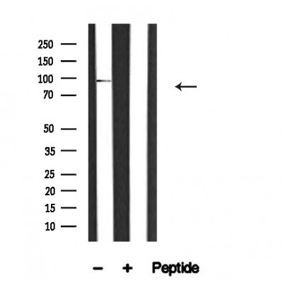 Western blot analysis of HPK1 in lysates of Raji?, using HPK1 Antibody(AF4628).