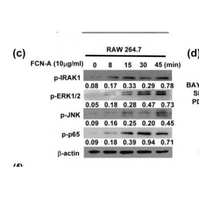 AF3320 staining 293 by IF/ICC. The sample were fixed with PFA and permeabilized in 0.1% Triton X-100,then blocked in 10% serum for 45 minutes at 25¡ãC. The primary antibody was diluted at 1/200 and incubated with the sample for 1 hour at 37¡ãC. An  Alexa Fluor 594 conjugated goat anti-rabbit IgG (H+L) Ab, diluted at 1/600, was used as the secondary antibod