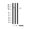 Western blot analysis of CYLD in lysates of 293?, using CYLD Antibody(AF4637).