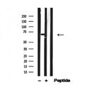Western blot analysis of IRAK1 in lysates of Jurkat?, using IRAK1 Antibody(AF4741).