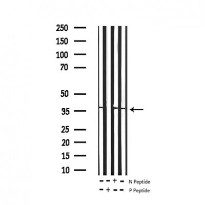AF3323 staining COS7 by IF/ICC. The sample were fixed with PFA and permeabilized in 0.1% Triton X-100,then blocked in 10% serum for 45 minutes at 25¡ãC. The primary antibody was diluted at 1/200 and incubated with the sample for 1 hour at 37¡ãC. An  Alexa Fluor 594 conjugated goat anti-rabbit IgG (H+L) Ab, diluted at 1/600, was used as the secondary antibod