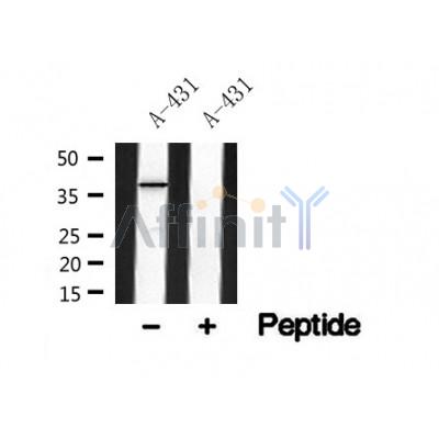 Western blot analysis of MERIT40 in lysates of A-431?, using MERIT40 Antibody(AF4798).