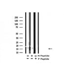Western blot analysis of Histone H3 (acetyl K14) in lysates of COLO205, using Histone H3 (acetyl K14) Antibody(AF4352).