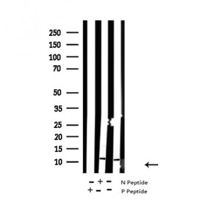 Western blot analysis of Histone H4 (acetyl K8) in lysates of A431, using Histone H4 (acetyl K8) Antibody(AF4353).