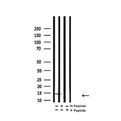 Western blot analysis of H2B (acetyl K16) in lysates of HeLa  TSA 1M, 18 hr, using H2B (acetyl K16) Antibody(AF4356).