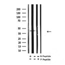 Western blot analysis of Acetyl-p53 (K373) in lysates of MDA-MB-435 UV, using Acetyl-p53 (K373) Antibody(AF4363).