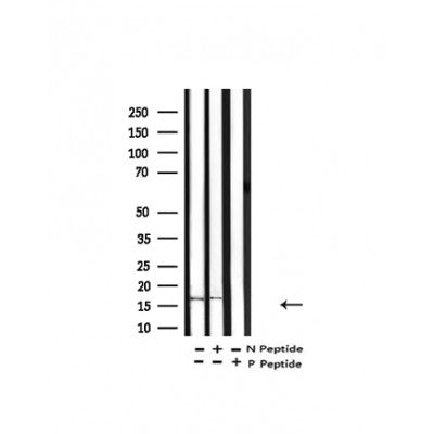 Western blot analysis of Acetyl-Histone H3 ( K9 / K14 /K18 / K23 /K27) in lysates of COLO205, using Acetyl-Histone H3 ( K9 / K14 /K18 / K23 /K27) Antibody(AF4365).