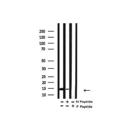 Western blot analysis of Acetyl-H2A.Z ( K4/7/11/13) in lysates of HeLa  TSA 1M, 18 hr, using Acetyl-H2A.Z ( K4/7/11/13) Antibody(AF4366).
