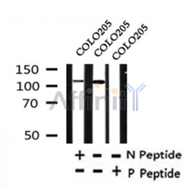 Western blot analysis of KIF11/Eg5 (Phospho-Thr926) in lysates of COLO205, using KIF11/Eg5 (Phospho-Thr926) Antibody(AF4445).
