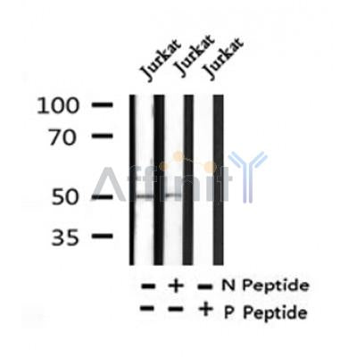 Western blot analysis of FOXL2 (Phospho-Ser238) in lysates of Jurkat?, using FOXL2 (Phospho-Ser238) Antibody(AF4449).