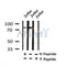 Western blot analysis of Breast Tumor Kinase (Phospho-Tyr447) in lysates of Jurkat?, using Breast Tumor Kinase (Phospho-Tyr447) Antibody(AF4468).