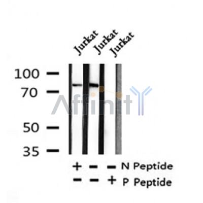 Western blot analysis of Breast Tumor Kinase (Phospho-Tyr447) in lysates of Jurkat?, using Breast Tumor Kinase (Phospho-Tyr447) Antibody(AF4468).