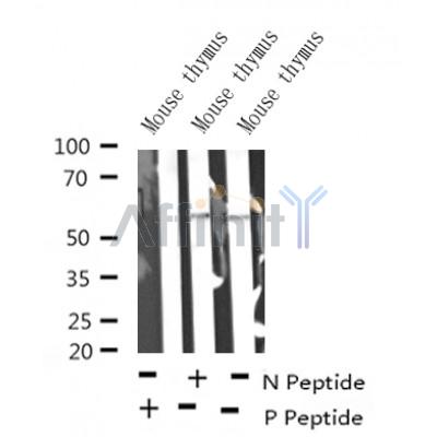 Western blot analysis of RUNX2 (Phospho-S340) in lysates of Mouse thymus?, using RUNX2 (Phospho-S340) Antibody(AF4470).