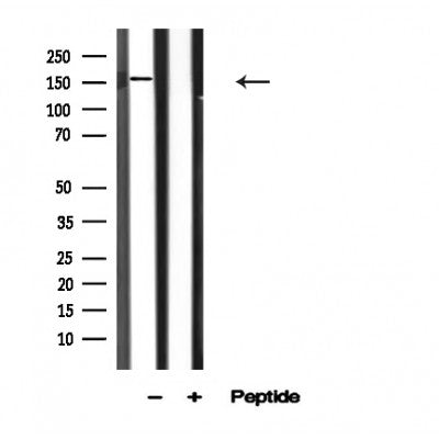 Western blot analysis of ROCK1 in lysates of NIH-3T3, using ROCK1 Antibody(AF4604).