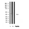 Western blot analysis of CK1A in lysates of MCF7?, using CK1A Antibody(AF4610).