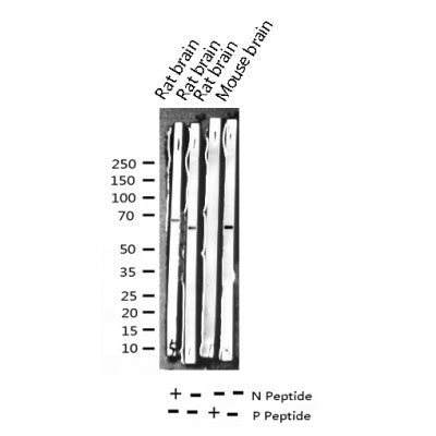 Western blot analysis of Phospho-Paxillin (Tyr31) expression in various lysates