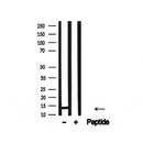 Western blot analysis of Histone H2A in lysates of A431, using Histone H2A Antibody(AF4654).