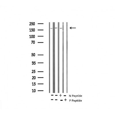 AF3334 staining 293 by IF/ICC. The sample were fixed with PFA and permeabilized in 0.1% Triton X-100,then blocked in 10% serum for 45 minutes at 25¡ãC. The primary antibody was diluted at 1/200 and incubated with the sample for 1 hour at 37¡ãC. An  Alexa Fluor 594 conjugated goat anti-rabbit IgG (H+L) Ab, diluted at 1/600, was used as the secondary antibod