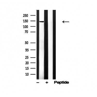 Western blot analysis of EPHA4 in lysates of SNB19, using EPHA4 Antibody(AF4675).