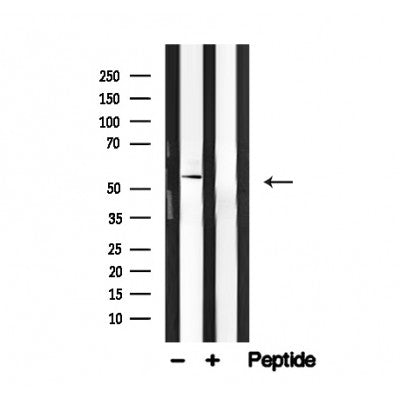 Western blot analysis of IRAK4 in lysates of ?serum-starved KARPAS-299?, using IRAK4 Antibody(AF4678).