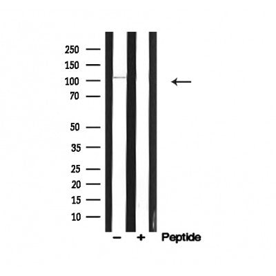 Western blot analysis of Catenin-1 in lysates of HuvEc, using Catenin-1 Antibody(AF4684).