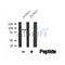 Western blot analysis of TrkA /TrkB in lysates of jurkat?, using TrkA /TrkB Antibody(AF4690).