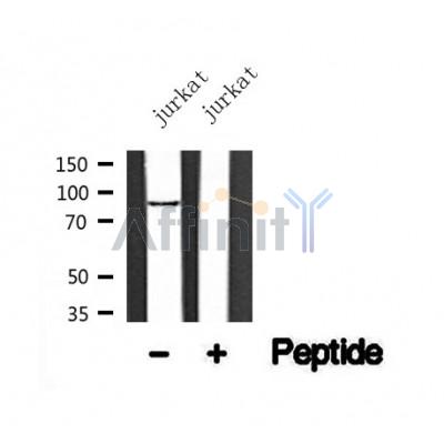 Western blot analysis of TrkA /TrkB in lysates of jurkat?, using TrkA /TrkB Antibody(AF4690).