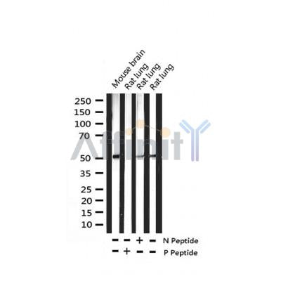 Western blot analysis of extracts from Hybridoma cells, using Phospho-GSK3 alpha (Ser21) Antibody. Lane 1 was treated with the blocking peptide.
