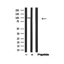 Western blot analysis of Na,K-ATPase 1 in lysates of A431, using Na,K-ATPase 1 Antibody(AF4691).