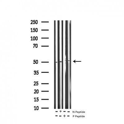AF3337 staining HeLa by IF/ICC. The sample were fixed with PFA and permeabilized in 0.1% Triton X-100,then blocked in 10% serum for 45 minutes at 25¡ãC. The primary antibody was diluted at 1/200 and incubated with the sample for 1 hour at 37¡ãC. An  Alexa Fluor 594 conjugated goat anti-rabbit IgG (H+L) Ab, diluted at 1/600, was used as the secondary antibod